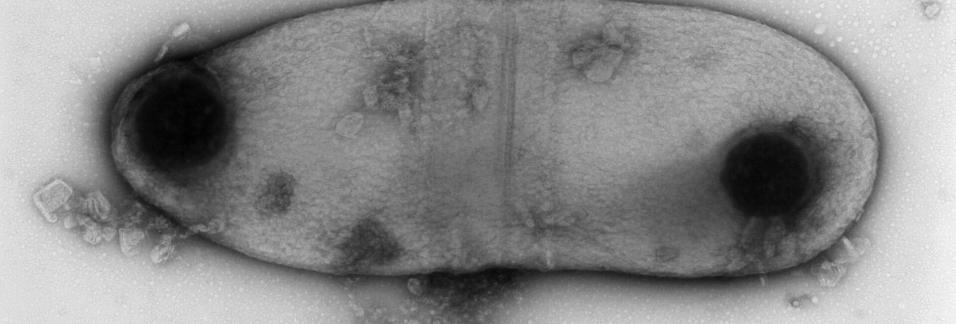 Mikroskopische Aufnahme des Diphtherie-Erregers