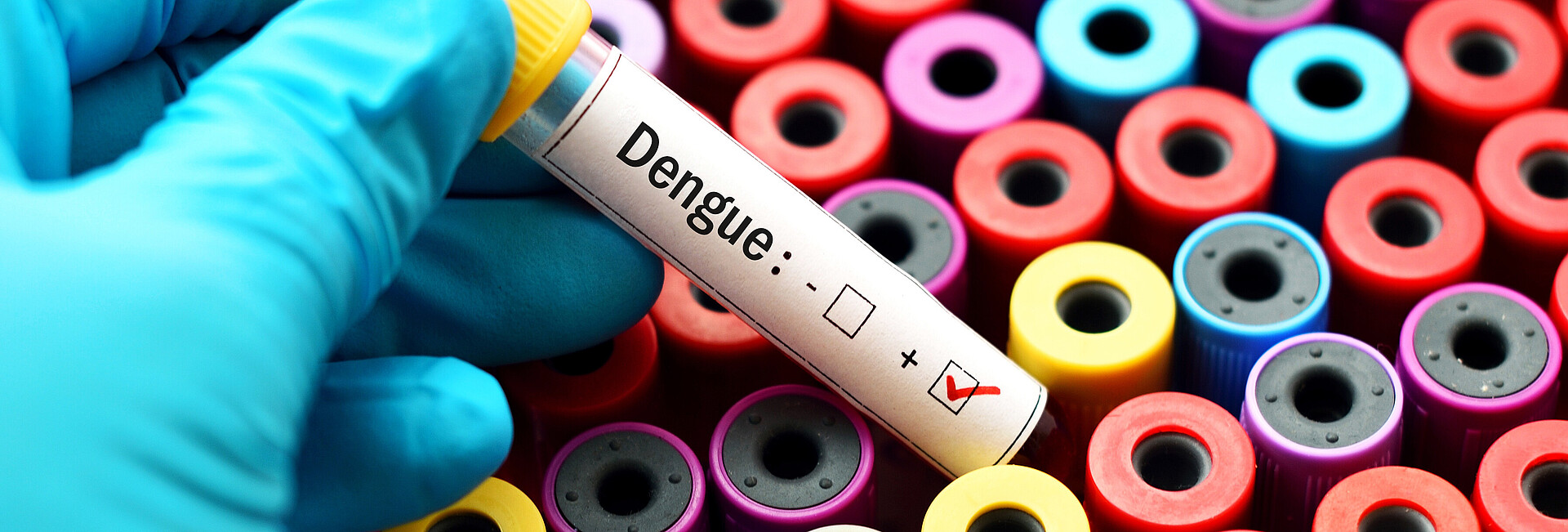 Eine behandschuhte Hand hält ein Blutprobenröhren mit Dengue positiv
