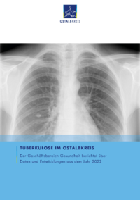 Vorschaubild: Tuberkulose im Ostalbkreis